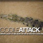 crocodile attacks surfer in costa rica