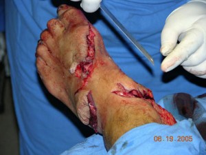 Volusia County Breaks Record for Shark Attacks in One Year Volusia County Breaks Record for Shark Attacks in One Year