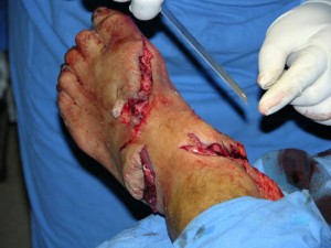 A young woman was attacked and bitten by a shark A young woman was attacked and bitten by a shark