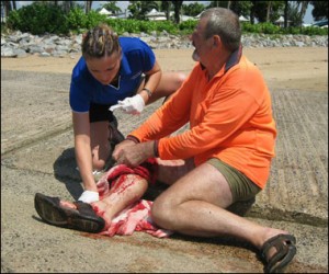 Genius Fisherman Attacked By Shark On His Own Boat shark2 380 615413a 300x250 Unlucky Fisherman Attacked By Shark On His Own Boat