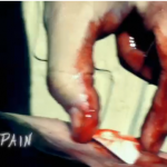 Bloody Maverick's Shark Attack? Bloody Maverick's Shark Attack?
